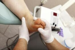 Doctor is taking care of the foot diabetes at Clear Step Podiatry