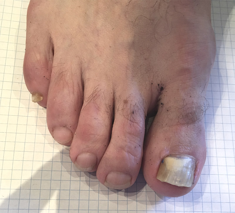 Doctor is taking care of patient feet
