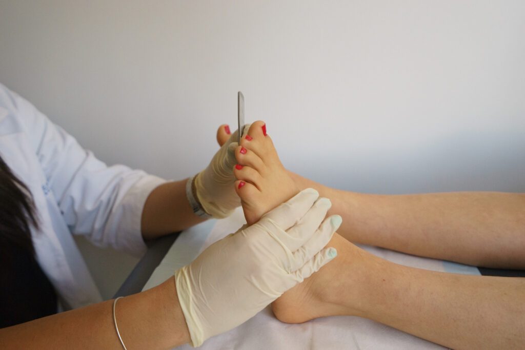 Podiatrist providing expert care to a patient's foot, addressing and treating corns and calluses to prevent further complications and ensure foot health.