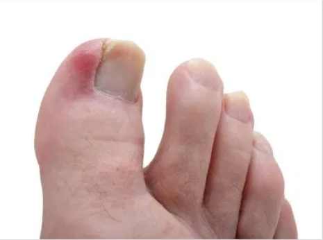 Doctor examine the patient's foot
