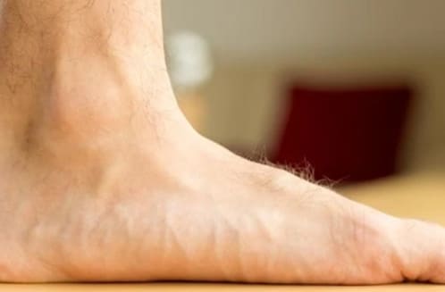 bare feet