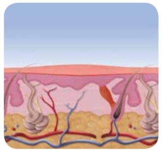 Healing by Swift device